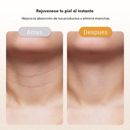 Masajeador Facial con Luz Infrarroja y Radiofrecuencia para Arrugas, Acne y Rejuvenecimiento | SkinGlow