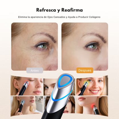 Masajeador Facial con Luz Infrarroja y Radiofrecuencia para Arrugas, Acne y Rejuvenecimiento | SkinGlow