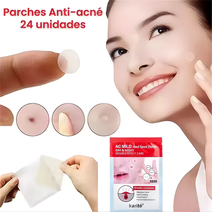Parche Anti-Acné | Curil